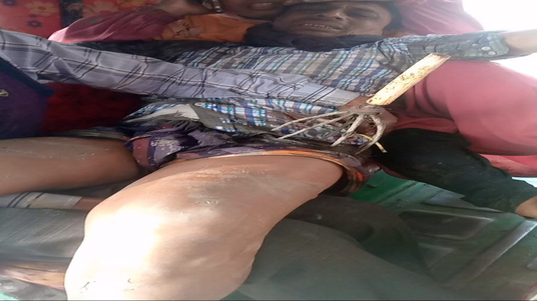 কচুয়ায় টেটা দিয়ে হামলা গুরুতর আহত-১ ঢাকা মেডিকেলে ভর্তি