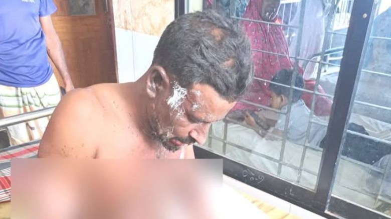 নওগাঁয় সাক্ষীর গায়ে পে,ট্রোল ঢেলে আ,গুন, মা,দক মামলার আসামিক