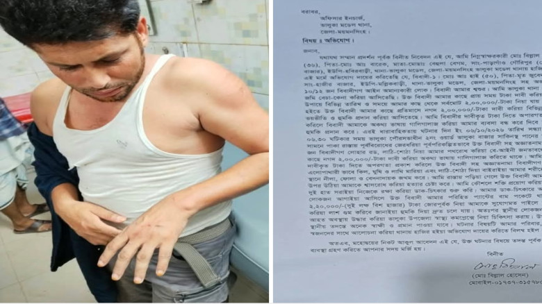 শ্বশুর কর্তৃক জামাইকে ভাড়াটিয়া সন্ত্রাসী বাহিনী দিয়ে মারধ